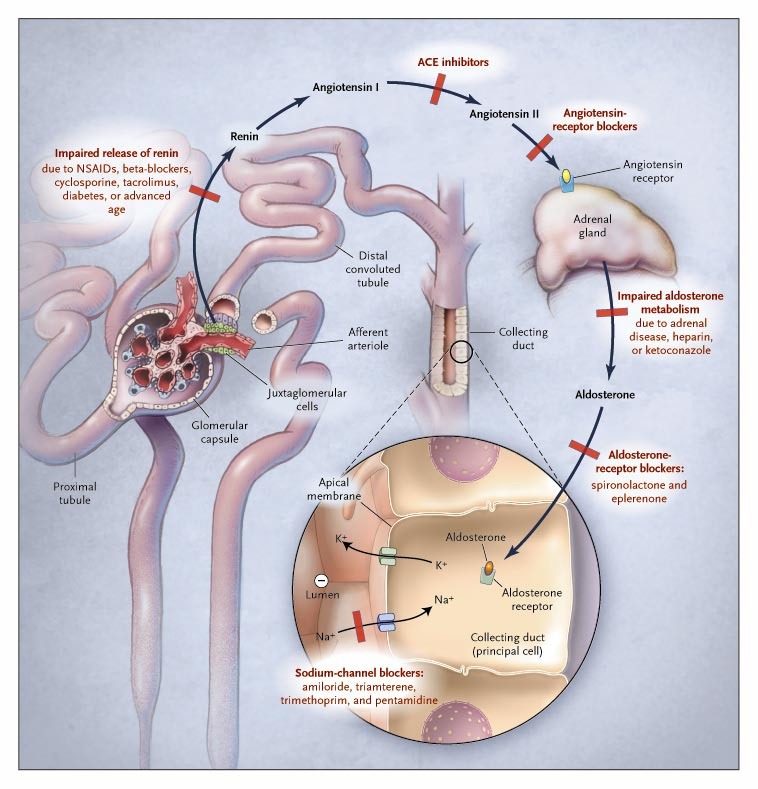 Hyperkalemia